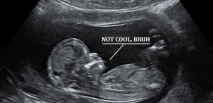 ultrasound.jpg