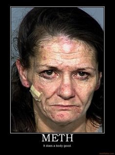 meth heads more photos meth addict toll meth kill horrible drugs ...