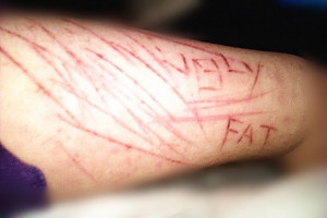 Some teenagers deal with depression by cutting themselves