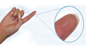 Glucowizzard Implant Sensors Monitors Blood Glucose Levels