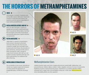 Avant/Après : Methamphetamine, la drogue qui détruit le corps humain