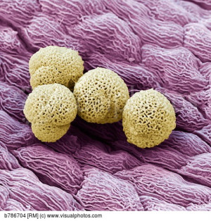 Pollen grains coloured SEM