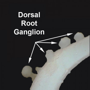 trka in rat dorsal root ganglion