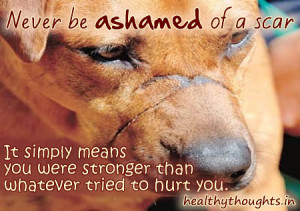 Never be ashamed of a scar.