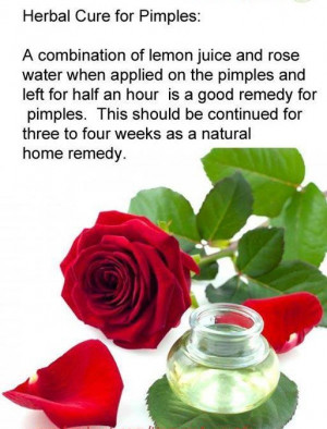 Herbal Cure for Pimples: