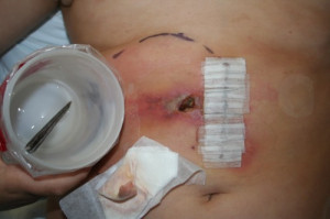 Displaying (19) Gallery Images For Stingray Sting Steve Irwin...