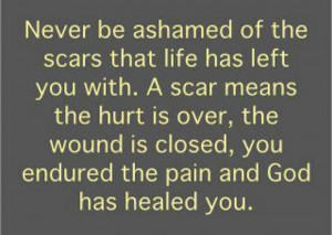 God heals!