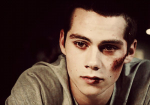 Teen Wolf’s Stiles Stilinski is 140 lbs of pale skin and fragile ...