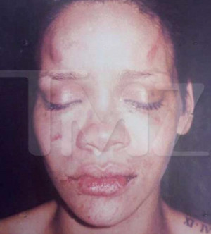 Female police officers 'who leaked photo of Rihanna after beating by ...
