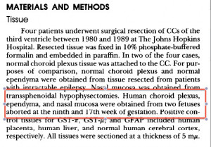 Dr. Ben Carson, Who Slammed Planned Parenthood for Donating Fetal ...
