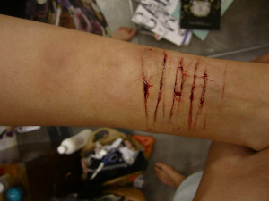 Depression Self Harm And...